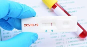 ABD’de meskende fiyatsız Covid-19 testi devri başlıyor!