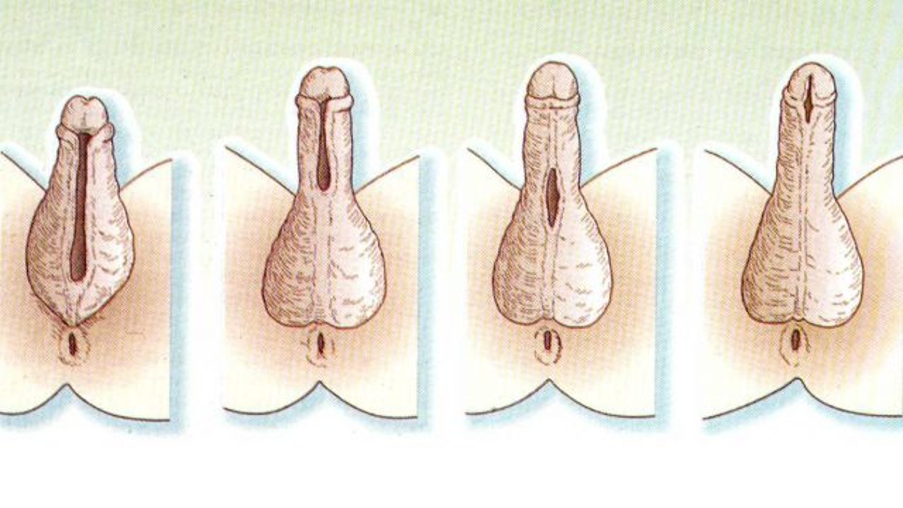 Ulaş Utku Bozdoğan: Hermafroditizm (Çift Cinsiyetlilik) Nedir? 5