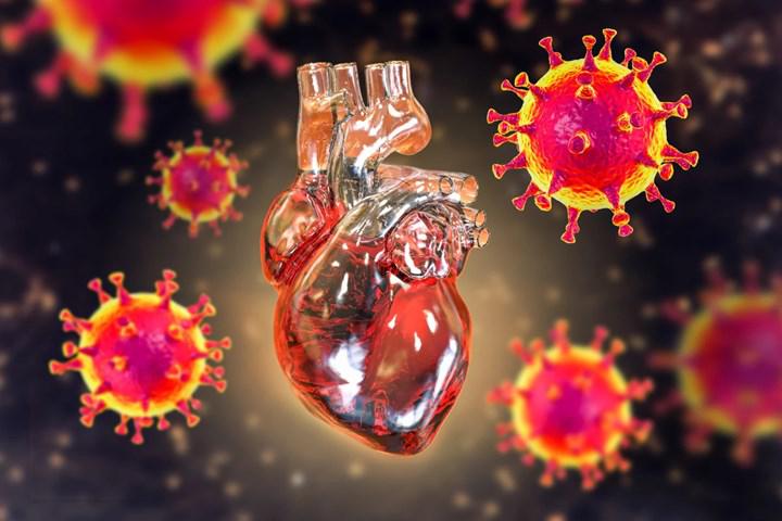Ulaş Utku Bozdoğan: Covid-19, Enfeksiyondan 1 Yıl Sonrasına Kadar Kalp Rahatsızlığı Riskini Artırıyor 1