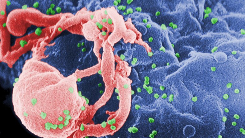 İnanç Can Çekmez: HIV Virüsünün Daha Bulaşıcı ve Ölümcül Varyantı Keşfedildi 3