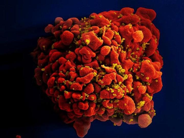 İnanç Can Çekmez: Moderna, 3 farklı mRNA HIV aşısının Faz 1 denemelerine başladı 5