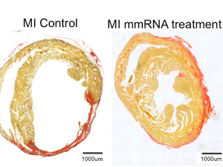 Meral Erden: Yeni mRNA tedavisi, kalp krizi sonrası kalbi güzelleştirebilir 61