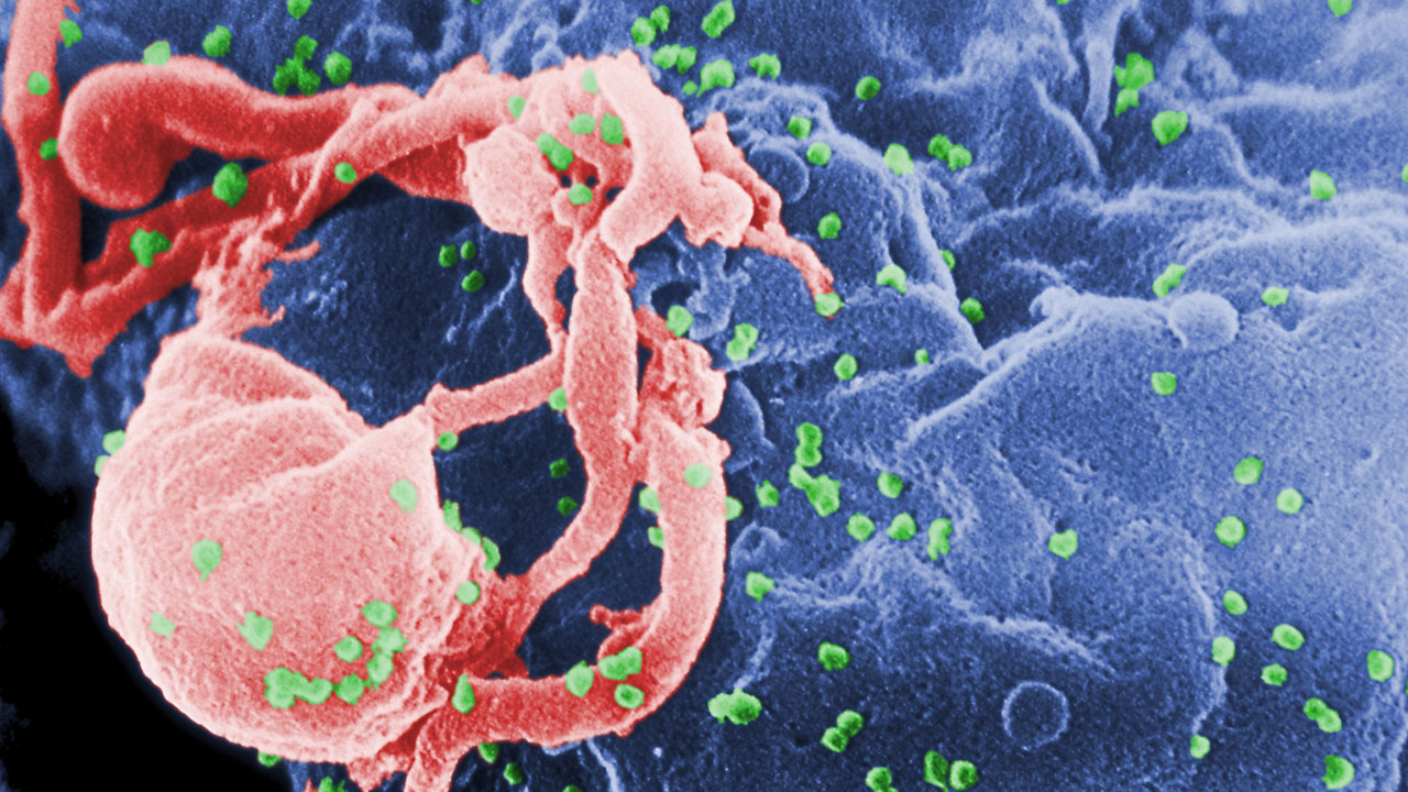 İnanç Can Çekmez: 66 Yaşındaki Bir Kişi, Tedaviyle HIV'den Kurtuldu 69