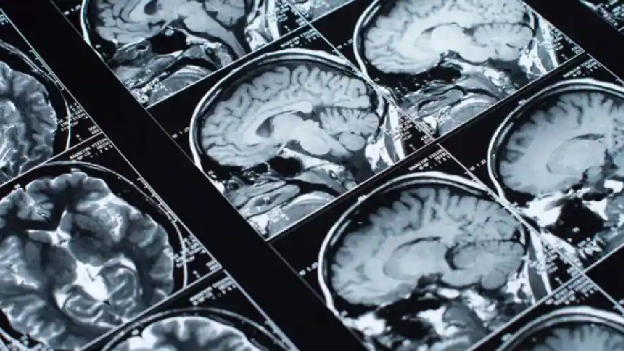 İnanç Can Çekmez: Beynimizin Binlerce Yıl Evvel Küçüldüğü Hipotezi Reddedildi 1