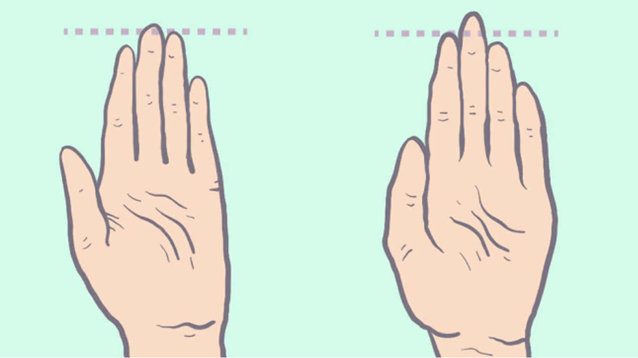 Meral Erden: Yüzük Parmağınızın Uzunluğu Karakterinizi Belirleyebilir! 19