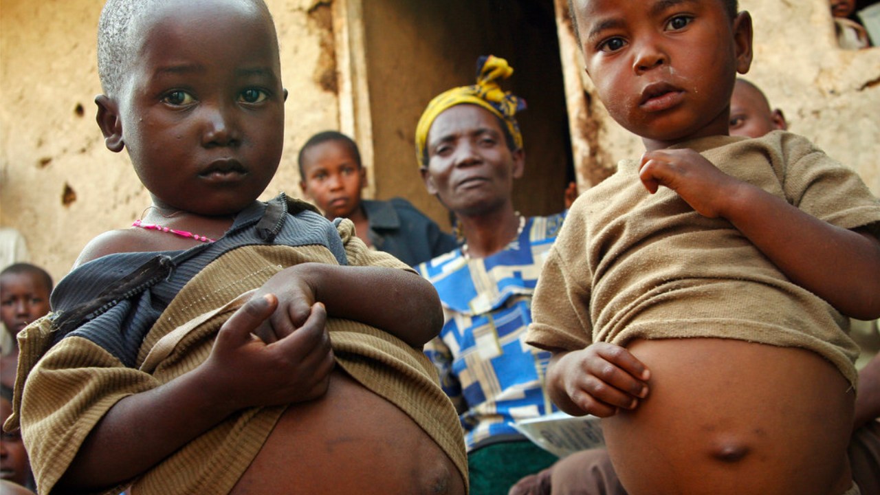 Şinasi Kaya: Açlık Çeken Çocukların Karınları Neden Şişkindir? - Webtekno 9