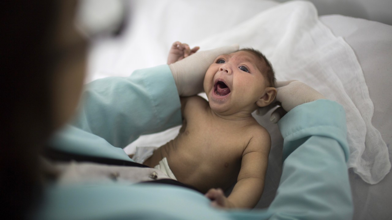 İnanç Can Çekmez: Bazı Yeni Doğan Bebeklerde Sıra Dışı Bir Kafa Görünümüne Sebebiyet Veren Rahatsızlık: Mikrosefali 5