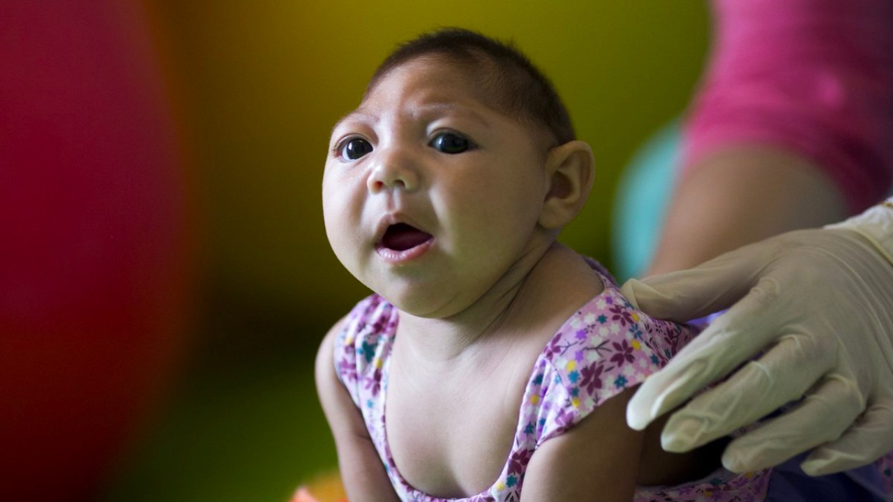 Meral Erden: Bazı Yeni Doğan Bebeklerde Sıra Dışı Bir Kafa Görünümüne Sebebiyet Veren Rahatsızlık: Mikrosefali 33