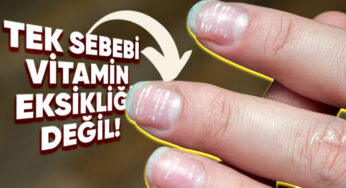 Tırnaklarımızda Oluşan Bu Beyaz Lekeler Ne Anlama Geliyor?