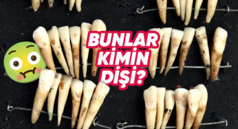 Diş Hekimliğinin Tarihçesi: 19. Yüzyıldaki Rahatsız Edici Uygulamalar