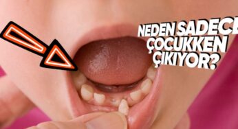 İnsan Vücudunun İki Kez Diş Çıkarmasının Evrimsel Nedeni