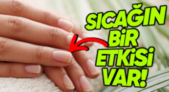 Sıcak Havalarda Tırnakların Hızlı Uzamasının Sebepleri