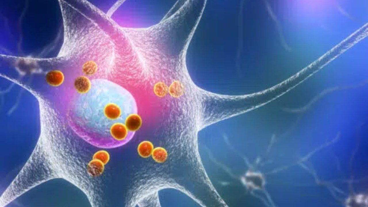 Meral Erden: Parkinson Hastalığında Cinsiyet Farklılıkları ve PINK1 Proteini 2 Parkinson Hastalığında Cinsiyet Farklılıkları ve PINK1 Proteini